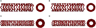 Application of in silico Platform for the Development and Optimization of Fully Bioresorbable Vascular Scaffold Designs